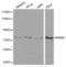 Inhibitor Of Nuclear Factor Kappa B Kinase Subunit Beta antibody, A2087, ABclonal Technology, Western Blot image 