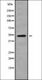 Synaptotagmin-2 antibody, orb337845, Biorbyt, Western Blot image 