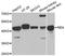 Renin antibody, A1585, ABclonal Technology, Western Blot image 