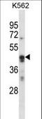 Activity Regulated Cytoskeleton Associated Protein antibody, LS-C156449, Lifespan Biosciences, Western Blot image 