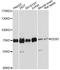 DEAD-Box Helicase 5 antibody, A13294, ABclonal Technology, Western Blot image 