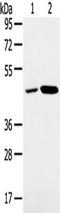 Sorting Nexin 5 antibody, TA351736, Origene, Western Blot image 
