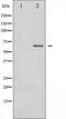 Mitogen-Activated Protein Kinase Kinase Kinase 7 antibody, TA325648, Origene, Western Blot image 