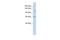 Zinc Finger And BTB Domain Containing 10 antibody, A08269, Boster Biological Technology, Western Blot image 