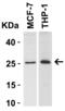 EPF antibody, 3335, ProSci Inc, Western Blot image 