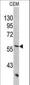 Keratin 10 antibody, LS-C165613, Lifespan Biosciences, Western Blot image 