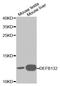 Defensin Beta 132 antibody, A1074, ABclonal Technology, Western Blot image 