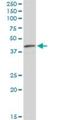 Calponin 3 antibody, H00001266-M01, Novus Biologicals, Western Blot image 