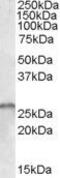 Survival Of Motor Neuron 2, Centromeric antibody, PA5-18682, Invitrogen Antibodies, Western Blot image 