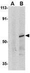 Interferon Regulatory Factor 8 antibody, GTX31696, GeneTex, Western Blot image 