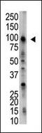 Ubiquitin Specific Peptidase 5 antibody, PA5-11999, Invitrogen Antibodies, Western Blot image 