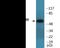 Lysine Acetyltransferase 5 antibody, EKC2210, Boster Biological Technology, Western Blot image 