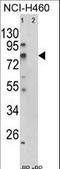 Acyl-CoA Synthetase Short Chain Family Member 3 antibody, LS-C155980, Lifespan Biosciences, Western Blot image 