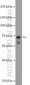 Non-SMC Condensin II Complex Subunit H2 antibody, 26172-1-AP, Proteintech Group, Western Blot image 