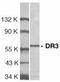 TNF Receptor Superfamily Member 25 antibody, PA1-30533, Invitrogen Antibodies, Western Blot image 