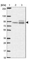 ABR Activator Of RhoGEF And GTPase antibody, NBP2-49152, Novus Biologicals, Western Blot image 