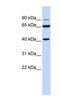 GDH antibody, NBP1-57903, Novus Biologicals, Western Blot image 