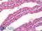 Paxillin antibody, LS-B8618, Lifespan Biosciences, Immunohistochemistry paraffin image 