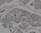 Heat Shock Protein 90 Alpha Family Class A Member 1 antibody, M01103-1, Boster Biological Technology, Immunohistochemistry paraffin image 