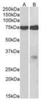 Glycoprotein M6A antibody, NBP1-68861, Novus Biologicals, Western Blot image 