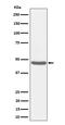 Branched Chain Keto Acid Dehydrogenase Kinase antibody, M07798-1, Boster Biological Technology, Western Blot image 