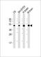 Solute Carrier Family 2 Member 3 antibody, M03259-1, Boster Biological Technology, Western Blot image 