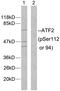 Activating Transcription Factor 2 antibody, LS-C117294, Lifespan Biosciences, Western Blot image 