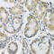 Mitochondrial Ribosomal Protein L1 antibody, 19-505, ProSci, Immunohistochemistry paraffin image 