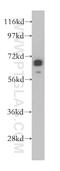 Zinc Finger Protein 410 antibody, 14529-1-AP, Proteintech Group, Western Blot image 
