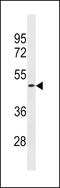 Olfactory receptor OR11-231 antibody, 60-658, ProSci, Western Blot image 