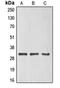 E74 Like ETS Transcription Factor 5 antibody, orb213890, Biorbyt, Western Blot image 