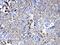Serpin Family A Member 5 antibody, A01916-1, Boster Biological Technology, Immunohistochemistry paraffin image 