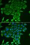 DnaJ Heat Shock Protein Family (Hsp40) Member B14 antibody, orb373272, Biorbyt, Immunocytochemistry image 