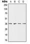Dehydrogenase/Reductase 7 antibody, LS-C353456, Lifespan Biosciences, Western Blot image 