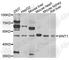 Wnt Family Member 1 antibody, A2475, ABclonal Technology, Western Blot image 