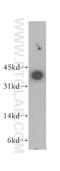 Nucleolar Protein Interacting With The FHA Domain Of MKI67 antibody, 12615-1-AP, Proteintech Group, Western Blot image 