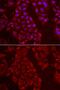 Tripeptidyl Peptidase 2 antibody, GTX16466, GeneTex, Immunocytochemistry image 