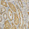 NADPH Oxidase 4 antibody, LS-C331983, Lifespan Biosciences, Immunohistochemistry frozen image 