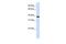 Glycerol-3-Phosphate Dehydrogenase 1 Like antibody, GTX45325, GeneTex, Western Blot image 