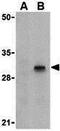 Caspase 8 antibody, GTX31285, GeneTex, Western Blot image 