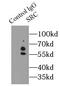 SRC Proto-Oncogene, Non-Receptor Tyrosine Kinase antibody, FNab08216, FineTest, Immunoprecipitation image 