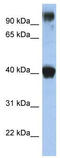 Transcription Factor AP-2 Epsilon antibody, TA329723, Origene, Western Blot image 
