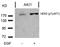 ERBB2 antibody, AP02373PU-S, Origene, Western Blot image 