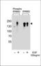 ERBB2 antibody, TA328148, Origene, Western Blot image 