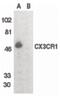 C-X3-C Motif Chemokine Receptor 1 antibody, PA5-19935, Invitrogen Antibodies, Western Blot image 