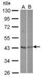 Testis Expressed 13A antibody, PA5-30769, Invitrogen Antibodies, Western Blot image 