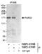 Rho GTPase Activating Protein 29 antibody, NBP1-05988, Novus Biologicals, Immunoprecipitation image 