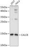 Calcitonin Related Polypeptide Beta antibody, GTX32484, GeneTex, Western Blot image 
