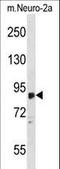 Zinc Finger DHHC-Type Containing 8 antibody, LS-C160765, Lifespan Biosciences, Western Blot image 