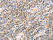 Tetratricopeptide Repeat Domain 23 antibody, CSB-PA100188, Cusabio, Immunohistochemistry paraffin image 